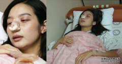 蒋金福袭击了这位明星对抗他的女友，即使遭到