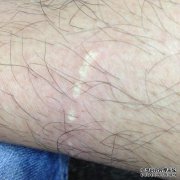 我总是觉得上腹部中间有一点。
