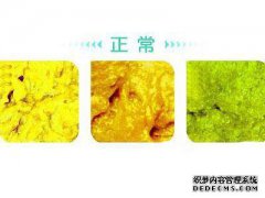 什么是正常的排便？
