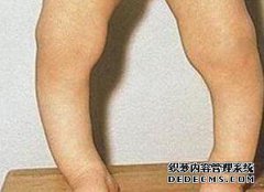 小儿病有哪些症状？儿童病的四个主要症状分析