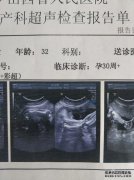 kb片段是什么意思？kb片段是什么意思？知识，知