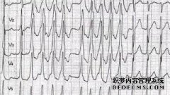 心室纤颤和心房纤颤有什么区别？